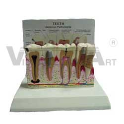 ANATOMICAL TEETH MODEL